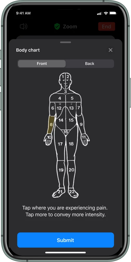 A screenshot of the body chart page.